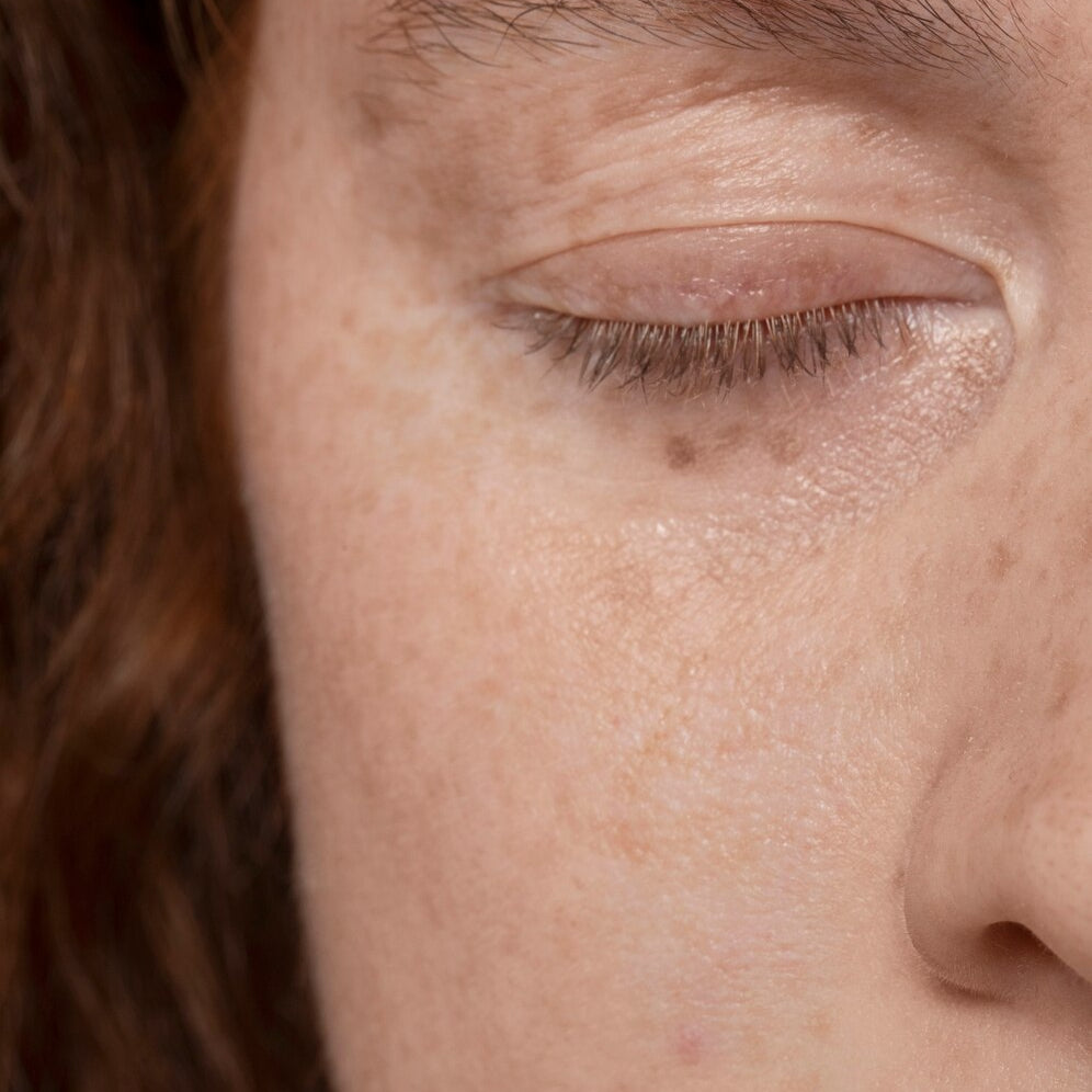Retinol for Beginners: Everything You Need to Know Before Starting