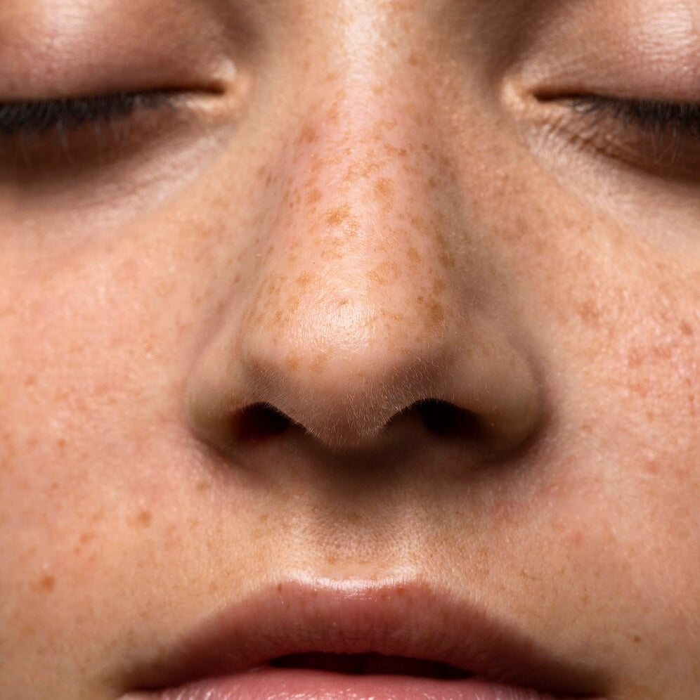 What Is Microbiome Skincare and Should You Try It?