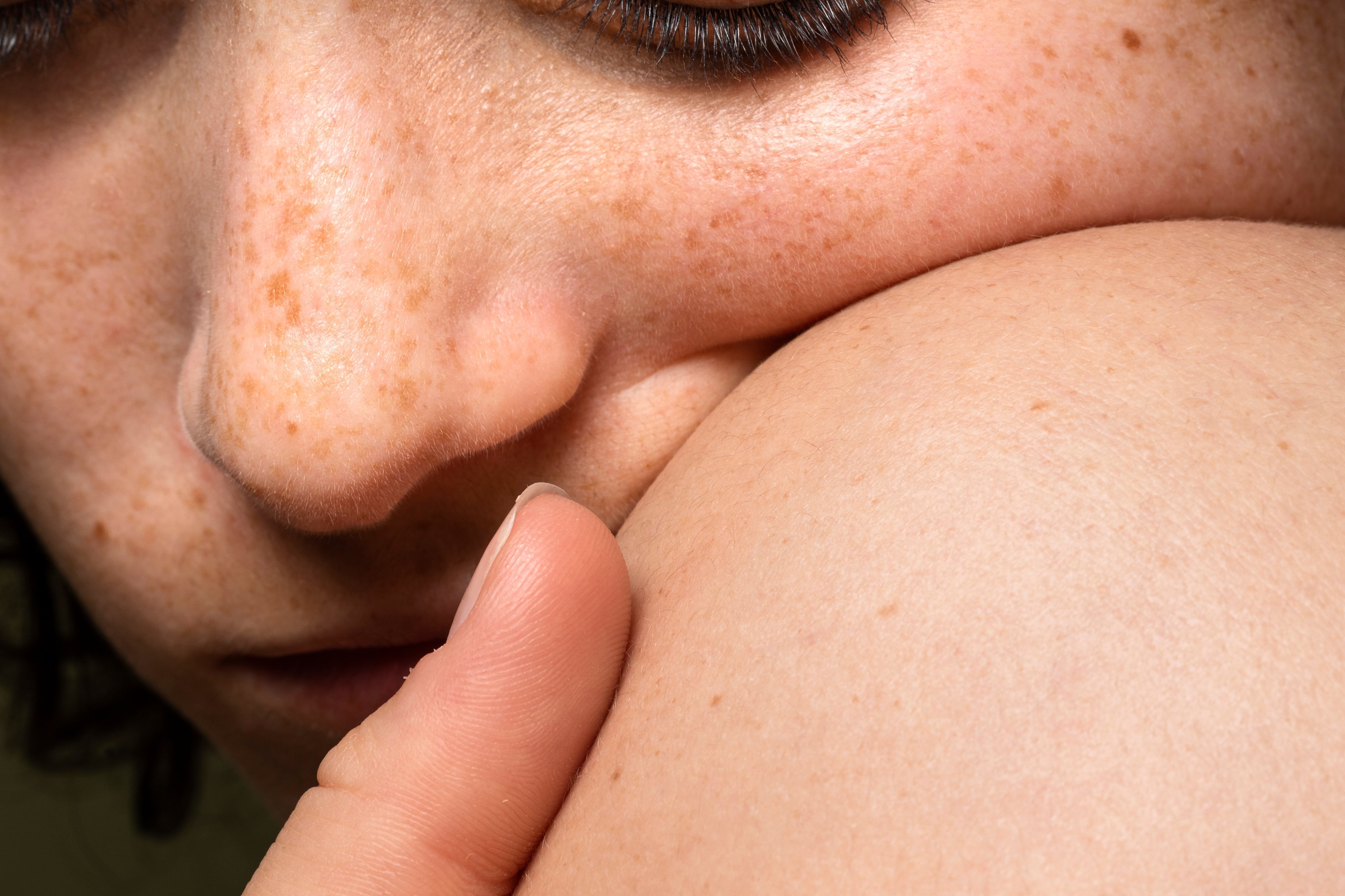 The Quiet Way Skin Cancer Shows Up — And Why We Miss It