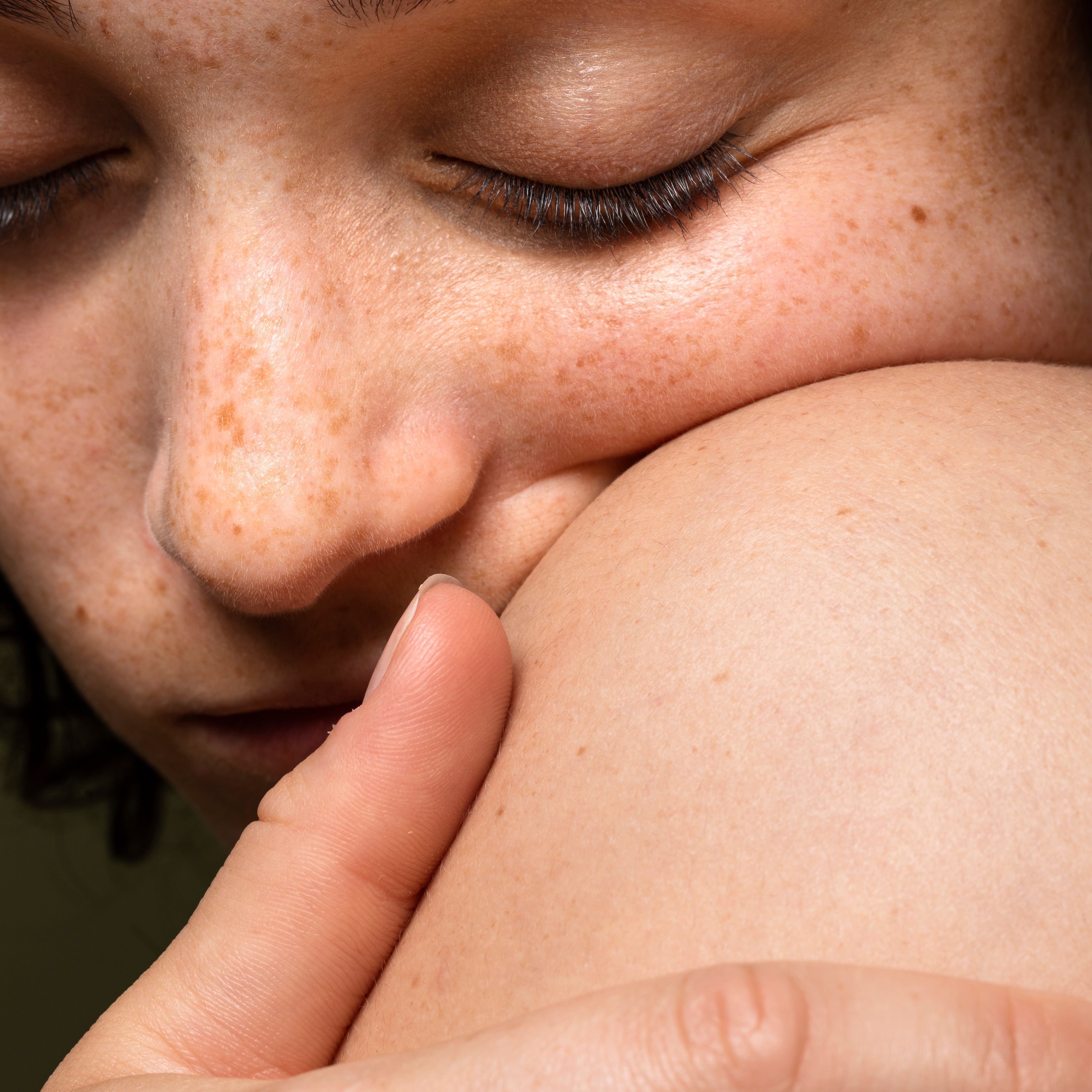 The Quiet Way Skin Cancer Shows Up — And Why We Miss It